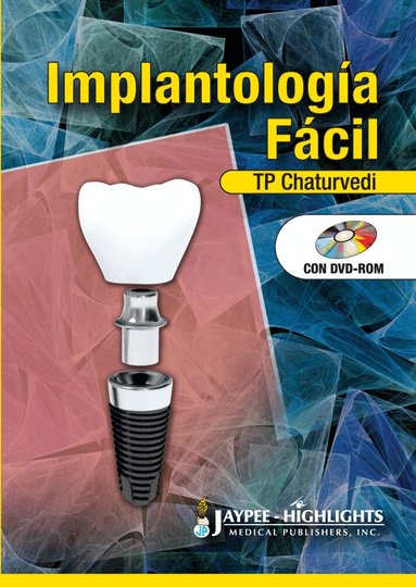 TP Chaturvedi - Implantología Fácil, Inbunden