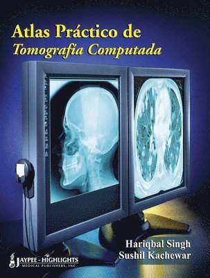 bokomslag Atlas Practico de Tomografia Computada