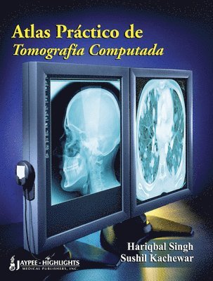 bokomslag Atlas Práctico de Tomografia Computada