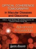Javier Montero, Sandeep Saxena - Optical Coherence Tomography in Macular Diseases and Glaucoma: Advanced Knowledge, Inbunden