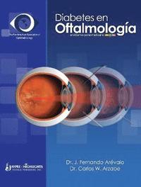 bokomslag Diabetes en Oftalmologia