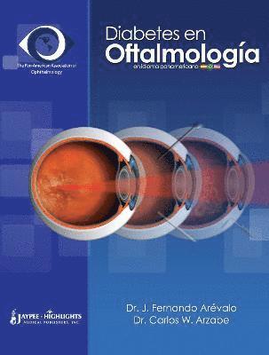 bokomslag Diabetes en Oftalmología