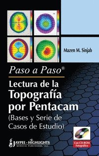 bokomslag Paso a Paso - Lectura de la Topografia por Pentacam