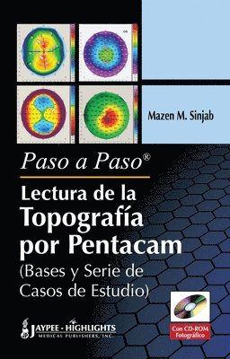 Paso a Paso - Lectura de la Topografia por Pentacam 1