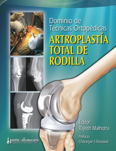 Rajesh Malhotra - Dominio de Técnicas Ortopédicas: Artroplastía Total de Rodilla, Inbunden