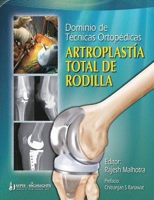 Dominio de Tecnicas Ortopedicas: Artroplastia Total de Rodilla 1