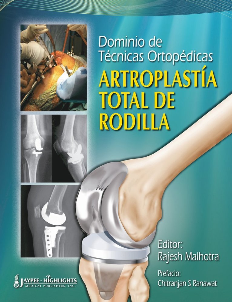 Dominio de Técnicas Ortopédicas: Artroplastía Total de Rodilla
