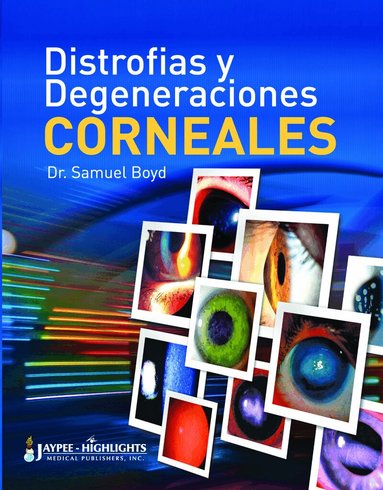 Samuel Boyd - Distrofías y Degeneraciones Corneales, Häftad
