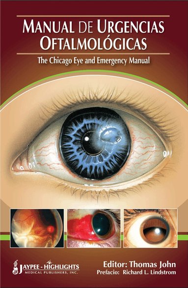 Thomas John - Manual de Urgencias Oftalmológicas - "The Chicago Eye and Emergency Manual", Häftad