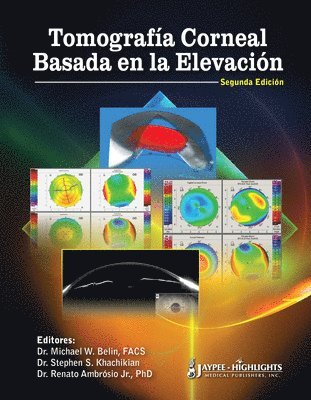 bokomslag Tomografía Corneal Basada en la Elevación