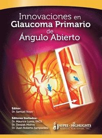 bokomslag Innovaciones en Glaucoma Primario de Angulo Abierto