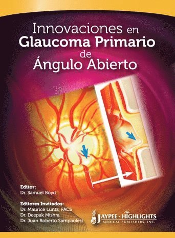 bokomslag Innovaciones en Glaucoma Primario de Ángulo Abierto
