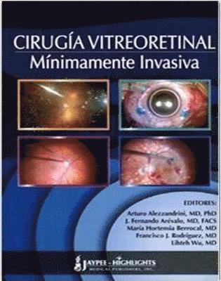 Arturo Alezzanrini, J Fernando Arévalo, Maria Hortensia Berrocal, Francisco J Rodrgiquez, Lihteh Wu, J Fernando Arevalo - Cirugía Vitreoretinal Mínimamente Invasiva, Inbunden