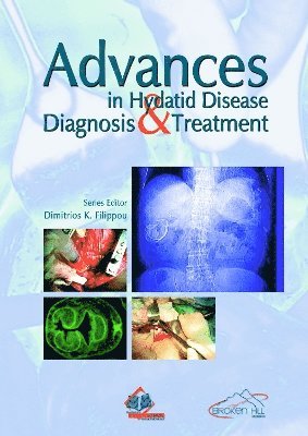 Advances in Hydatid Disease 1