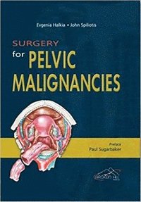 bokomslag Surgery for Pelvic Malignancies