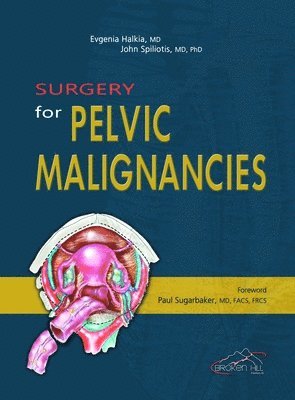 bokomslag Surgery for Pelvic Malignancies