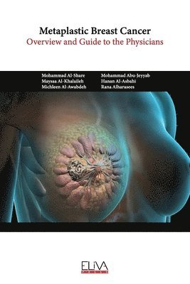 bokomslag Metaplastic Breast Cancer
