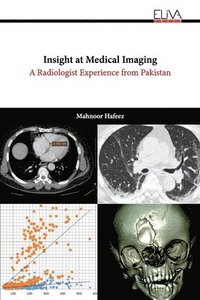 bokomslag Insight at Medical Imaging