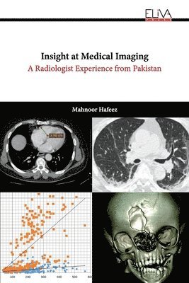 bokomslag Insight at Medical Imaging