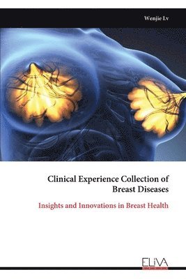 bokomslag Clinical Experience Collection of Breast Diseases