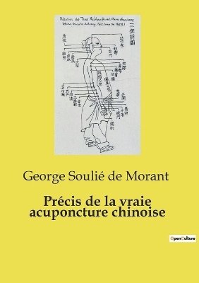 bokomslag Précis de la vraie acuponcture chinoise