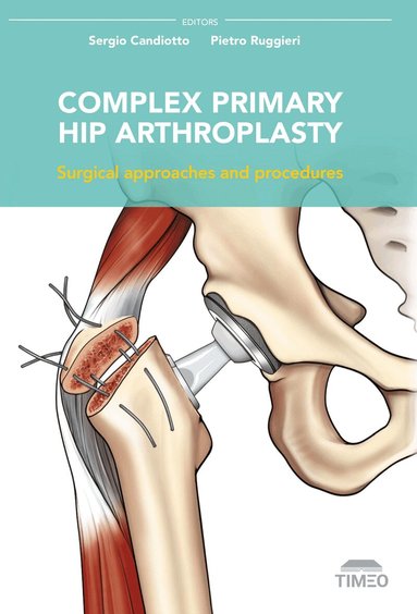 Complex Primary Hip Arthroplasty, Inbunden