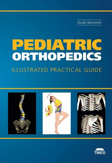 Guido Barneschi - Pediatric Orthopedics, Inbunden