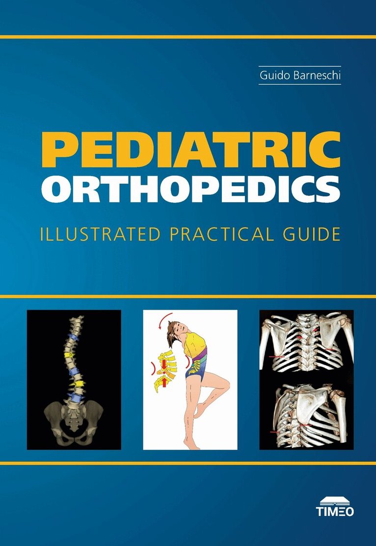 Guido Barneschi - Pediatric Orthopedics, Inbunden
