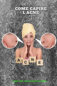 bokomslag Come capire l'acne