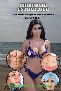 bokomslag Chirurgie esthétique