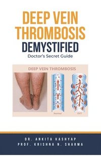 bokomslag Deep Vein Thrombosis Demystified: Doctor's Secret Guide