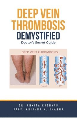 bokomslag Deep Vein Thrombosis Demystified