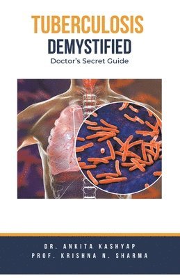 Ankita Kashyap, Prof Krishna N Sharma, Prof Krishna N. Sharma, Dr. Ankita Kashyap, Prof. Krishna N. Sharma, Krishna N. Sharma - Tuberculosis Demystified, Häftad