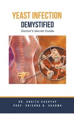 Ankita Kashyap, Prof Krishna N Sharma, Prof Krishna N. Sharma, Dr. Ankita Kashyap, Prof. Krishna N. Sharma, Krishna N. Sharma - Yeast Infection, Häftad