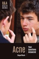 bokomslag Acne