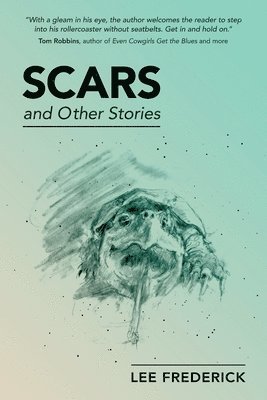 Scars 1