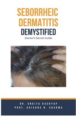 bokomslag Seborrheic Dermatitis Demystified