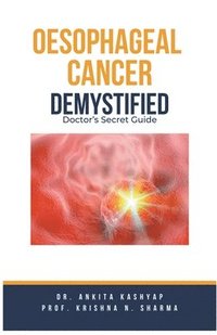 bokomslag Oesophageal Cancer Demystified Doctors Secret Guide