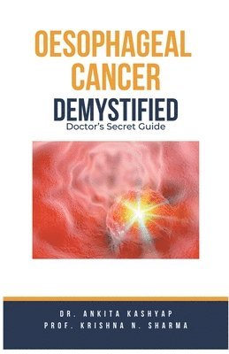 Oesophageal Cancer Demystified Doctors Secret Guide 1