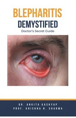 Ankita Kashyap, Prof Krishna N Sharma, Prof Krishna N. Sharma, Dr. Ankita Kashyap, Prof. Krishna N. Sharma, Krishna N. Sharma - Blepharitis Demystified, Häftad