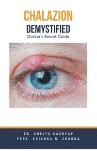 bokomslag Chalazion Demystified