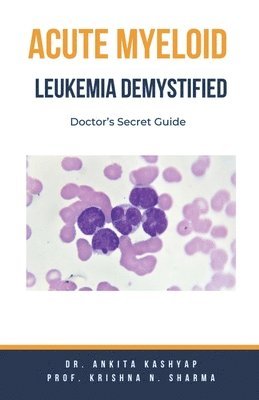 bokomslag Acute Myeloid Leukemia Demystified