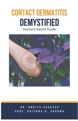 Contact Dermatitis Demystified