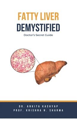 bokomslag Fatty Liver Demystified