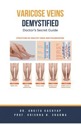 bokomslag Varicose Veins Demystified