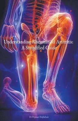 Understanding Rheumatoid Arthritis 1