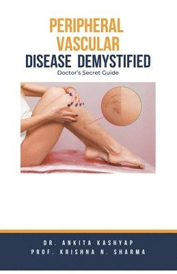 Ankita Kashyap, Prof Krishna N Sharma, Prof Krishna N. Sharma, Dr. Ankita Kashyap, Prof. Krishna N. Sharma, Krishna N. Sharma - Peripheral Vascular Disease Demystified, Häftad