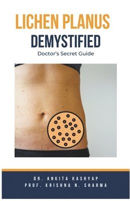 bokomslag Lichen Planus Demystified Doctors Secret Guide