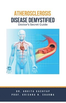 Ankita Kashyap, Prof Krishna N Sharma, Prof Krishna N. Sharma, Dr. Ankita Kashyap, Prof. Krishna N. Sharma, Krishna N. Sharma - Atherosclerosis Demystified, Häftad