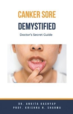 bokomslag Canker Sore Demystified